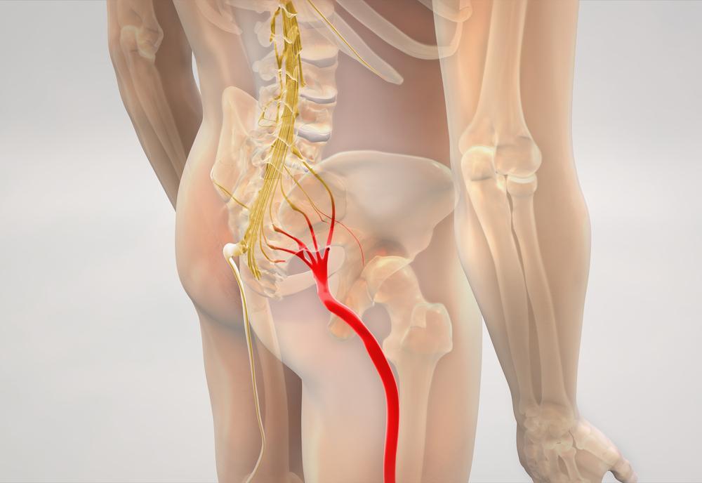 sciatica pain treatment chiropractic Maple Grove | Maple Grove chiropractor for sciatica pain treatment