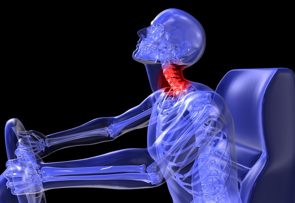 whiplash treatment chiropractic St. Michael, MN | St. Michael chiropractor for whiplash treatment