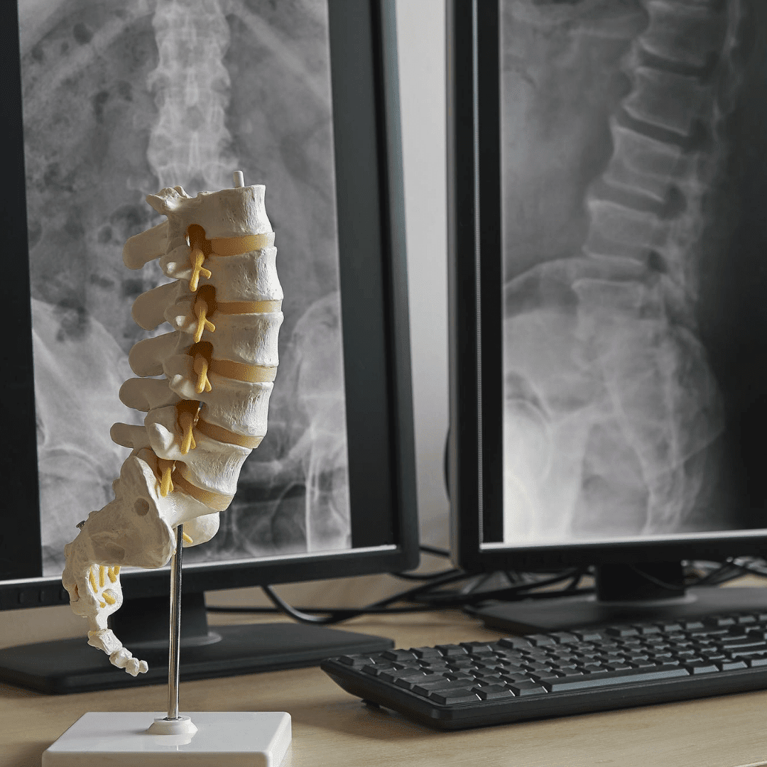 Xray for Gonstead chiropractic technique