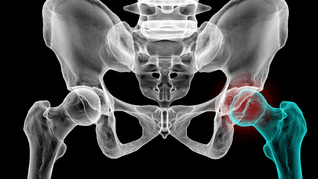 Hip joint dysfunction